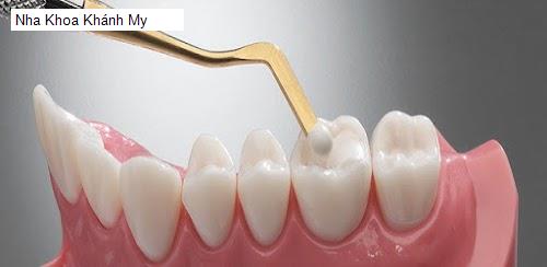 Hình ảnh Nha Khoa Khánh My